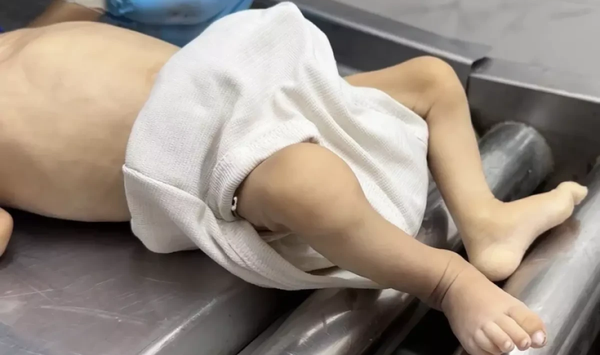 Gazze’de Yürek Yakan Çığlık: “Bir kutu mama yoksa, hepimiz öleceğiz”